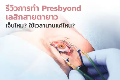 ทำ Presbyond เลสิกสายตายาว เป็นอย่างไร เจ็บไหม ใช้เวลานานแค่ไหน
